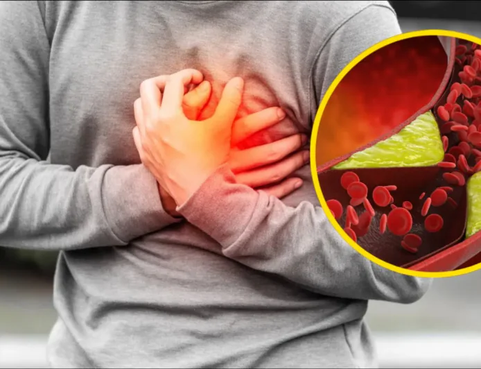 क्या आपके शरीर में बढ़ रहा है कोलेस्ट्रॉल? जानें इसके कारण, असर और नियंत्रण के उपाय