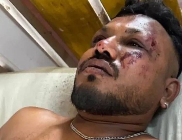 अहमदाबाद विमान हादसा: 242 यात्रियों में से रमेश कुमार चमत्कारिक रूप से ज़िंदा बचे, भाई लापता