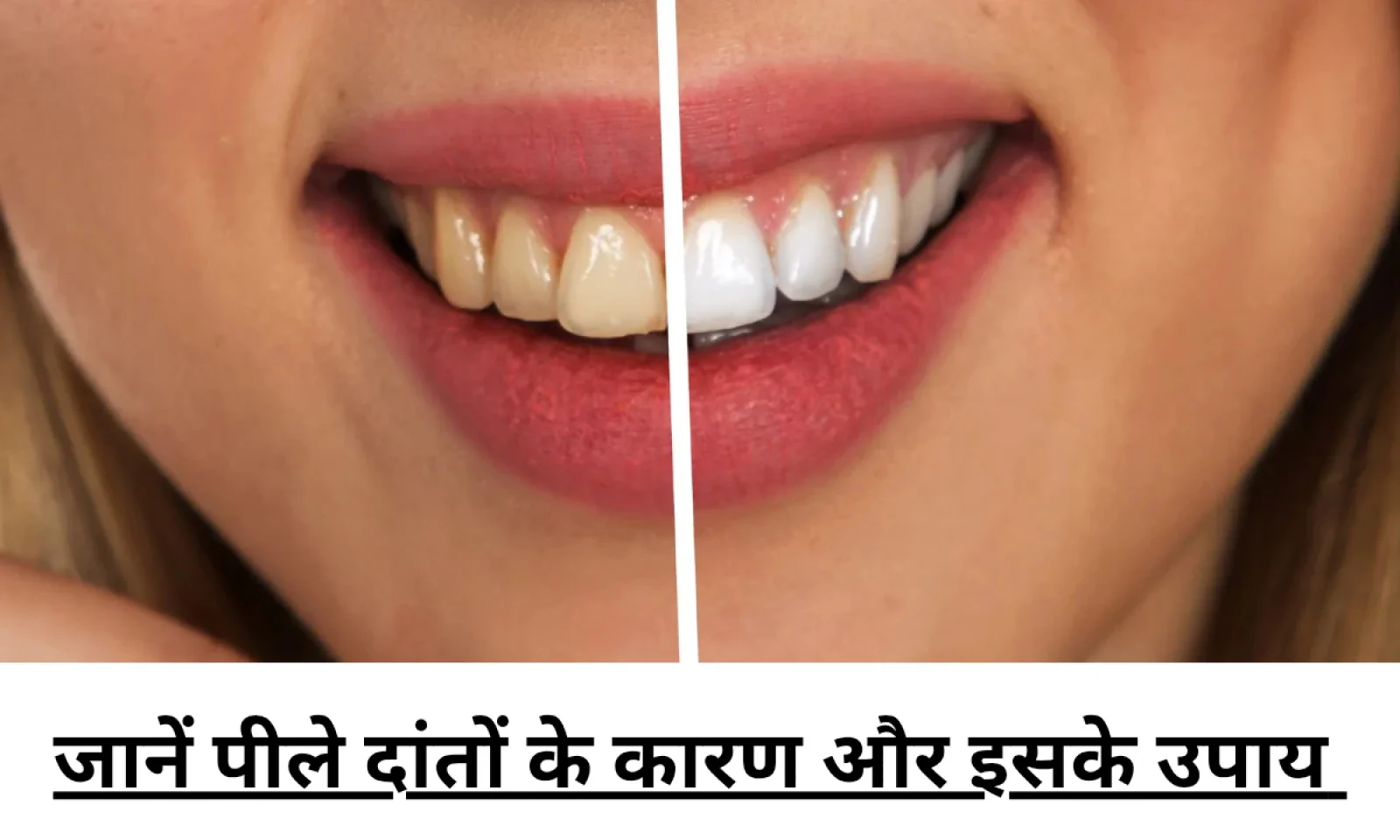 अगर आप भी है पीले दांतों से परेशान तो जानें इसकी असली वजह और अपनाए बेहतरीन उपाय
