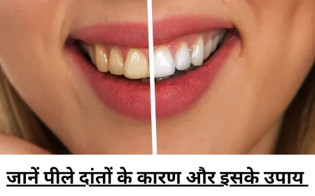 अगर आप भी है पीले दांतों से परेशान तो जानें इसकी असली वजह और अपनाए बेहतरीन उपाय