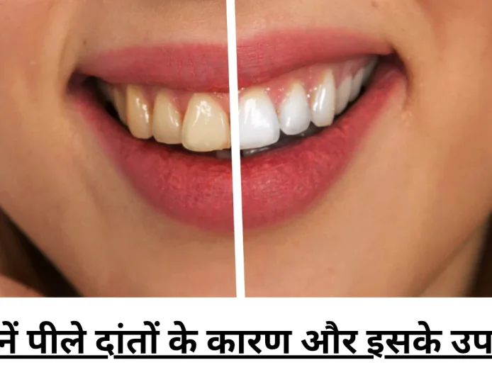 अगर आप भी है पीले दांतों से परेशान तो जानें इसकी असली वजह और अपनाए बेहतरीन उपाय