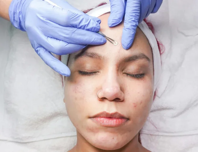 पिंपल्स हो रहे है बार बार तो हो जाए सावधान जानें इसके कारण और इन्हें ठीक करने के उपाय