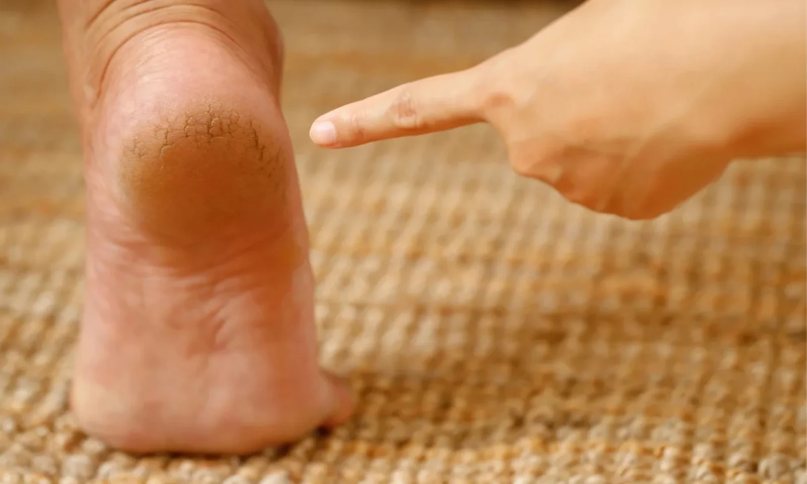 सर्दियों में अभी से फुट हील का ध्यान रखना करें शुरू अपनाए कुछ आसान से घरेलू उपाय