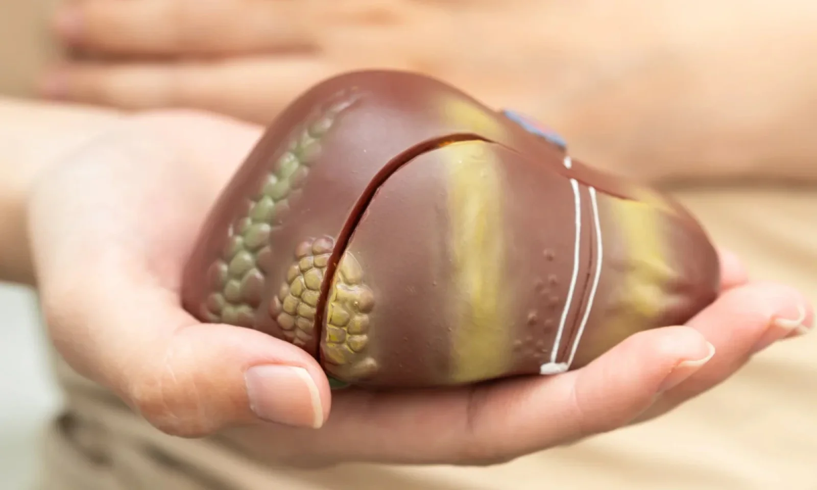 आप भी है फैटी लिवर से परेशान जानें इस के लक्षण और बचाव के उपाय और प्रॉपर ट्रीटमेंट