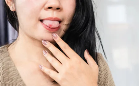 अगर बार बार मुंह के छाले से है परेशान तो अपनाएं आसान उपाय और पाएं तुरंत रिलीफ