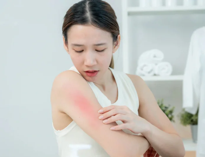 तेज कड़कती हुई गर्मी में सनबर्न से करें खुद का बचाव जानें कारण और बचने के उपाय