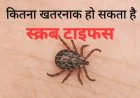 सिरमौर में बरसात के साथ स्क्रब टाइफस का खतरा, डॉक्टर की चेतावनी- ये लक्षण दिखें तो न करें इलाज में देरी