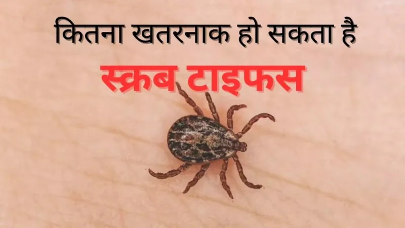 सिरमौर में बरसात के साथ स्क्रब टाइफस का खतरा, डॉक्टर की चेतावनी- ये लक्षण दिखें तो न करें इलाज में देरी